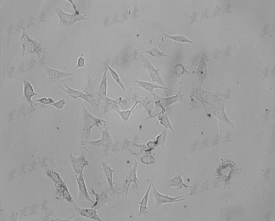 肝星状细胞.jpg