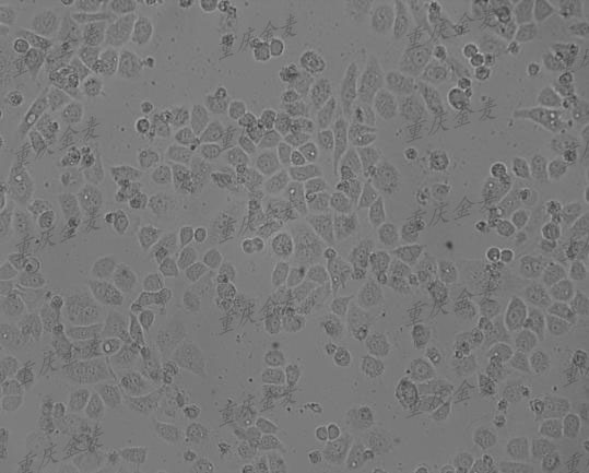 细胞质粒转染1.jpg