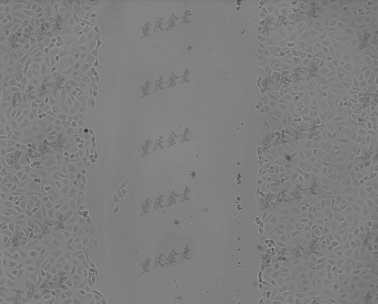 细胞划痕实验1.jpg